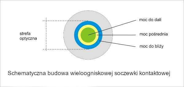 Dwuogniskowa soczewka kontaktowa do kontroli krótkowzroczności. 